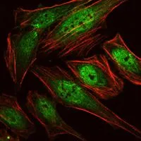 ICC/IF analysis of HeLa cells using GTX60402 RUNX1 antibody [5A1]. Green : RUNX1 Red: Actin filaments