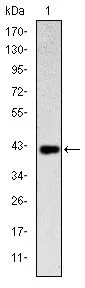 WB analysis of human CD94 (AA: 32-179) recombinant protein using GTX60405 CD94 antibody [1H1].