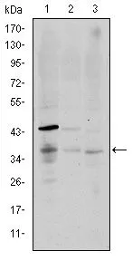 WB analysis of K562 (1), Raji (2), and MOLT4 (3) cell lysate using GTX60416 CD1a antibody [6H3].