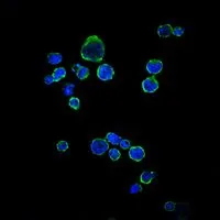 ICC/IF analysis of RAJI cells using GTX60418 CD1a antibody [7A7]. Green : CD1a Blue: DRAQ5 fluorescent DNA dye