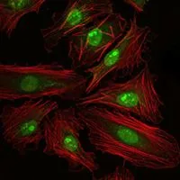 ICC/IF analysis of HeLa cells using GTX60431 CREB antibody [5G3]. Green : CREB Red: Actin filaments