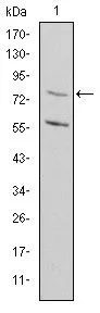 WB analysis of Rat heart tissue lysate using GTX60435 MTHFR antibody [5D3].