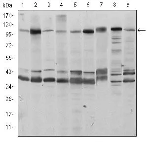 ELISA analysis of antigen using GTX60438 FUK antibody [6E2]. Red : Control antigen 100ng Purple : Antigen 10ng Green : Antigen 50ng Blue : Antigen 100ng