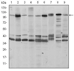 WB analysis of HeLa (1), HepG2 (2), Jurkat (3), A431 (4), HEK293 (5), MCF-7 (6), PC-12 (7), Cos7 (8), and NIH3T3 (9) cell lysate using GTX60438 FUK antibody [6E2].