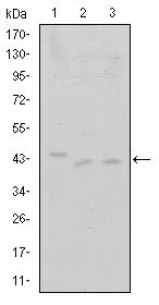 WB analysis of Jurkat (1), A431 (2) and HEK293 (3) cell lysate using GTX60443 CDK9 antibody [1B5D10].