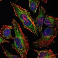 ICC/IF analysis of HeLa cells using GTX60444 HSP27 antibody [5D7]. Green : HSP27 Blue: DRAQ5 fluorescent DNA dye Red: Actin filaments
