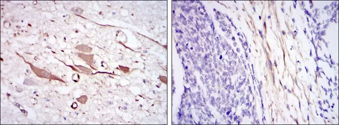 IHC-P analysis of human brain tissue (left) and esophageal cancer tissue (right) using GTX60444 HSP27 antibody [5D7].