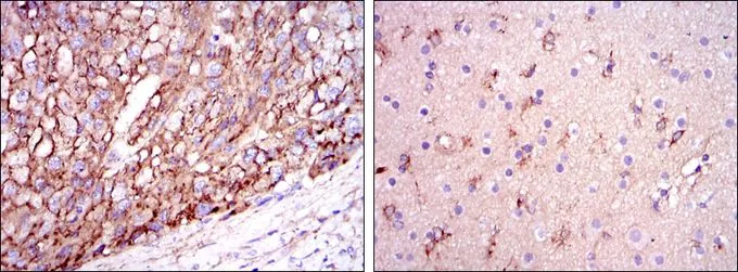 IHC-P analysis of liver cancer tissue (left) and brain tissue (right) using GTX60446 Apolipoprotein E antibody [1H4].