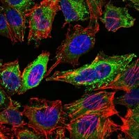 ICC/IF analysis of HeLa cells using GTX60447 ABCG2 antibody [3G8]. Green : ABCG2 Blue: DRAQ5 fluorescent DNA dye Red: Actin filaments