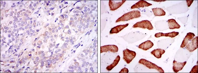IHC-P analysis of bladder cancer tissue (left) and skeletal muscle tissue (right) using GTX60447 ABCG2 antibody [3G8].