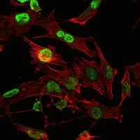 ICC/IF analysis of U251 cells using GTX60449 OTX2 antibody [1H12G8B2]. Green : OTX2 Red: Actin filaments