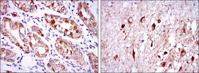 IHC-P analysis of human stomach tissue (left) and brain tissue (right) using GTX60449 OTX2 antibody [1H12G8B2].