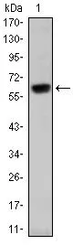 WB analysis of human OTX2 (AA: 40-297) recombinant protein using GTX60449 OTX2 antibody [1H12G8B2].