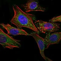 ICC/IF analysis of HeLa cells using GTX60450 ABCG2 antibody [1H2]. Green : ABCG2 Blue: DRAQ5 fluorescent DNA dye Red: Actin filaments