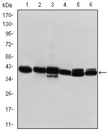 WB analysis of T47D (1), MCF-7 (2), SKBR-3 (3), HepG2 (4), Caco-2 (5) and SW620 (6) cell lysate using GTX60457 Cytokeratin 19 antibody [1H6].