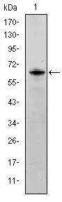 WB analysis of human FYN (AA: 7-176) recombinant protein using GTX60460 FYN antibody [2A10].