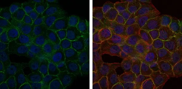 ICC/IF analysis of HepG2 cells using GTX60463 BLNK antibody [5G9]. Green : BLNK Blue: DRAQ5 fluorescent DNA dye Red: Actin filaments