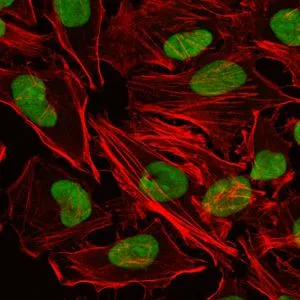 ICC/IF analysis of HeLa cells using GTX60468 Ku80 antibody [5C5]. Green : Ku80 Red: Actin filaments