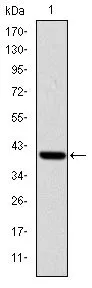 WB analysis of human ITK (AA: 2-120) recombinant protein using GTX60475 ITK antibody [5G6].