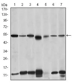 WB analysis of THP-1 (1),HeLa (2),K562 (3),MCF-7 (4),RAW264.7 (5),Jurkat (6) and Cos7 (7) cell lysate using GTX60479 IRAK4 antibody [2H9].