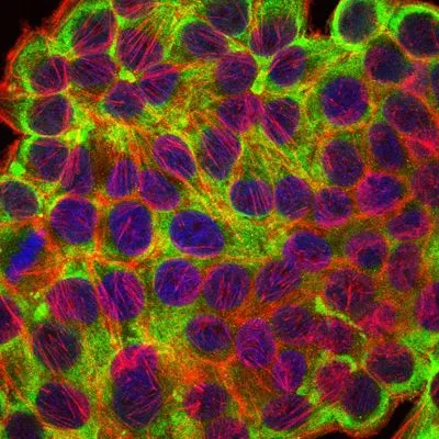 ICC/IF analysis of HepG2 cells using GTX60480 Cytokeratin 19 antibody [4E8]. Green : Cytokeratin 19 Blue: DRAQ5 fluorescent DNA dye Red: Actin filaments