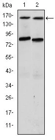 WB analysis of T47D (1) and MCF-7 (2) cell lysate using GTX60494 AIB1 antibody [5H3].