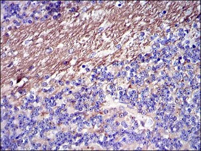 IHC-P analysis of human cerebellum tissue using GTX60502 Fibrinogen gamma antibody [4H9].