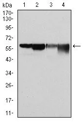 WB analysis of HeLa (1), MCF-7 (2), Jurkat (3) and K562 (4) cell lysate using GTX60518 G6PD antibody [2H7].