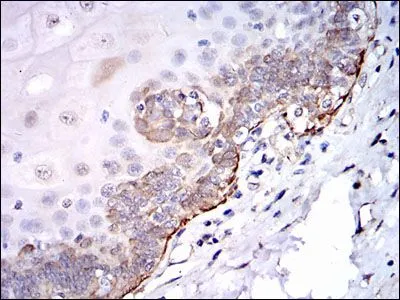 IHC-P analysis of human esophageal tissue using GTX60521 Src antibody [1F11].