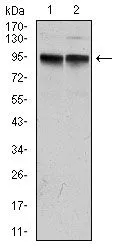 WB analysis of MCF-7 (1) and A431 (2) cell lysate using GTX60528 KCNQ1 antibody [5E12].