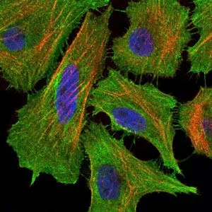 ICC/IF analysis of HeLa cells using GTX60557 Fas antibody [4F8H6]. Green : Fas Blue: DRAQ5 fluorescent DNA dye Red: Actin filaments
