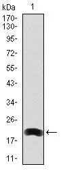 WB analysis of human LRP5 (AA: 1422-1615) recombinant protein using GTX60567 LRP5 antibody [2B11].