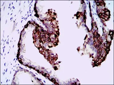 IHC-P analysis of human prostate tissue using GTX60588 HAS3 antibody [3C9].
