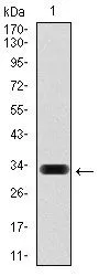 WB analysis of human HAS3 (AA: 312-364) recombinant protein using GTX60588 HAS3 antibody [3C9].