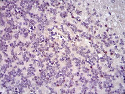 IHC-P analysis of human cerebellum tissue using GTX60591 c-Fos antibody [2G2].