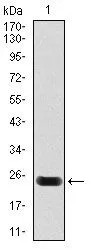 WB analysis of human Cardiac Troponin T (AA: 88-249) recombinant protein using GTX60592 Cardiac Troponin T antibody [1G1].