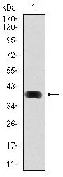 WB analysis of human LC3B (AA: 1-125) recombinant protein using GTX60594 LC3B antibody [5H12].