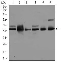 WB analysis of A431 (1), K562 (2), HeLa (3), NIH3T3 (4), PC-12 (5), and MCF-7 (6) cell lysate using GTX60600 JNK1 antibody [1E5].