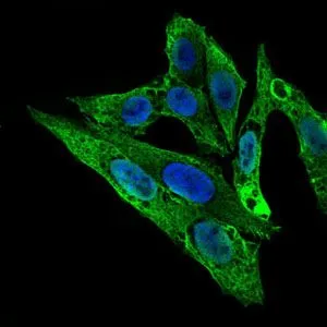 ICC/IF analysis of HepG2 cells using GTX60618 Rho GDI alpha antibody [2G3]. Green : Rho GDI alpha Blue: DRAQ5 fluorescent DNA dye