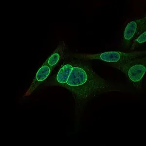 ICC/IF analysis of HepG2 cells using GTX60623 GCNF antibody [4G8]. Green : GCNF Blue: DRAQ5 fluorescent DNA dye