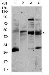WB analysis of K562 (1), Jurkat (2), Raji (3), and MOLT4 (4) cell lysate using GTX60631 CD5 antibody [6A11].