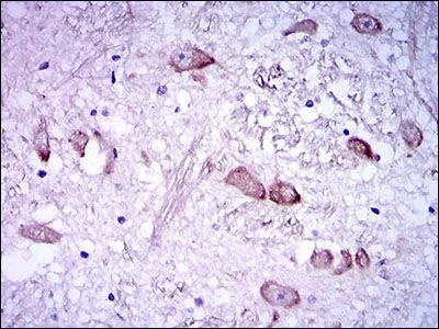 IHC-P analysis of human medulla oblongata tissue using GTX60650 NF-H antibody [8H10].