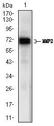 WB analysis of A431 cell lysate using GTX60669 MMP2 antibody [4D1E2].