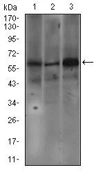WB analysis of SW620 (1), A549 (2), and A431 (3) cell lysate using GTX60720 Fc epsilon R1 alpha antibody [1F2A9].