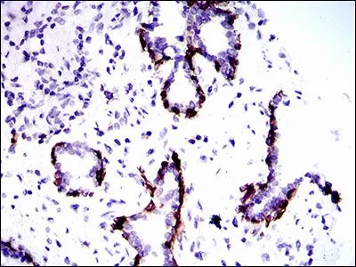 IHC-P analysis of human prostate tissue using GTX60722 Cytokeratin 5 antibody [10C11E6].