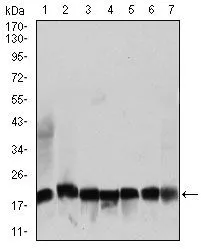 WB analysis of NIH3T3 (1), HEK293 (2), HL60 (3), Jurkat (4), Raji (5), MOLT4 (6), and HeLa (7) cell lysate using GTX60728 RPL18A antibody [6G6G10].
