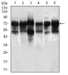 WB analysis of Jurkat (1), HeLa (2), HEK293 (3), A549 (5), SPC-A-1 (6) cell lysate, and Rat brain (4) tissue lysate using GTX60733 WHSC2 antibody [6B11H8].