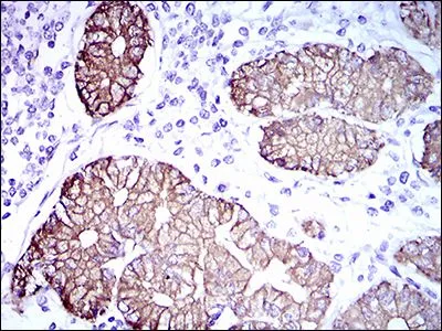 IHC-P analysis of human stomach tissue using GTX60749 Cytokeratin 5 antibody [2C2B4].