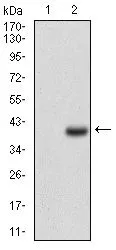 WB analysis of HEK293 (1) and CD7 (AA: 72-175)-hIgGFc transfected HEK293 (2) cell lysate using GTX60756 CD7 antibody [4D4F8].