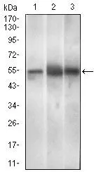 WB analysis of Mouse brain (1), Rat spleen (2), Mouse liver (3) cell lysate using GTX60758 PAX3 antibody [7D8G7].
